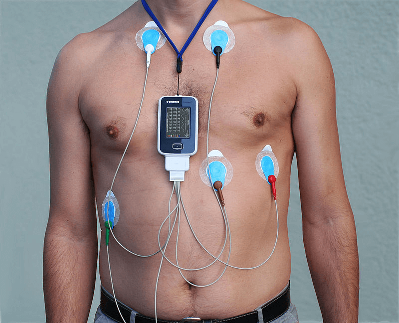 Holter Monitoring