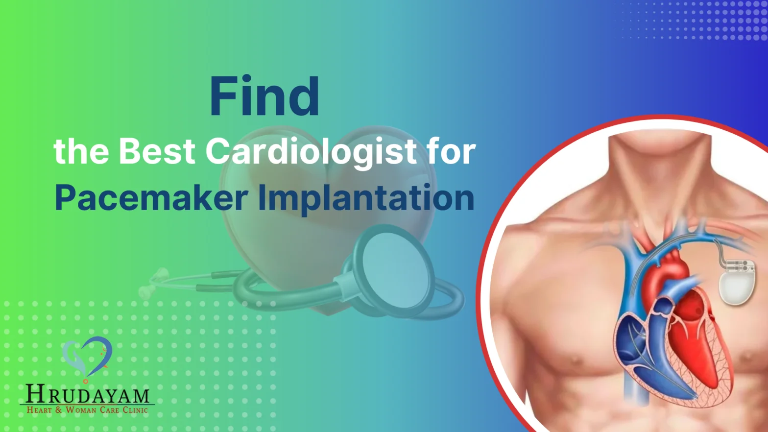 How to Find the Best Cardiologist for Pacemaker Implantation